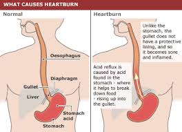 17 cara menghilangkan jerawat secara alami. Cara Hilangkan Pedih Ulu Hati Segera 1 Cara Hilangkan Gastrik Dengan Ubat Gastrik Alkalising Cara Menghilangkan Uban Secara Alami Dan Permanen Foto Nidasama Nusa