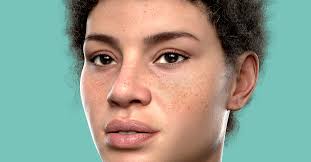 Image result for Freckled skin
