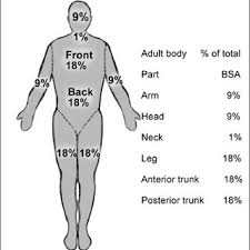 Special Considerations In Paediatric Burn Patients Request Pdf