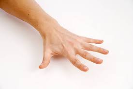 Häufige, akute oder chronische entzündung von sehnen und zugehörigem sehnengleitgewebe. Sehnenscheidenentzundung Der Hand Symptome Ursachen Therapie Ubungen Gelenk Klinik De