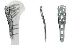 Proximal Humerus Locking Plates – TST