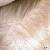 Lice In Blonde Hair