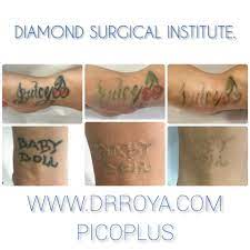Patients should also consider the number of treatments that may be necessary to treat a particular tattoo. Laser Tattoo Removal Specialist Encino Ca Diamond Surgical Institute Cosmetic Surgeon