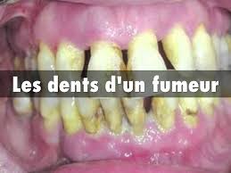 Des milliers de nouvelles images de grande qualité ajoutées chaque jour. Le Tabagisme By Eriksipple