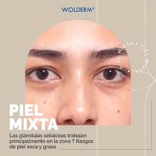 Conoce los principales tipos de piel y descubre cómo cuidarla. 🌟Piel grasa  (Aspecto brillante Tendencia a acné por la producción excesiva de sebo)  🌟Piel seca (Textura áspera y poros cerrados) 🌟Piel mixta (