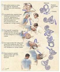 Jama On Twitter Physical Therapy Physical Therapy Exercises Vertigo Exercises