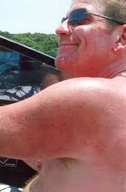 Mitchell Dale Herd Obituary