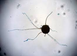 Image result for Uncinula necator