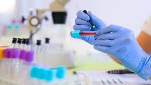 Utilizamos cookies essenciais e tecnologias semelhantes de acordo com a nossa política de privacidade e, ao continuar navegando, você concorda com estas condições. Artigo Exames Laboratoriais Necessidade Ou Desperdicio Associacao De Gastroenterologia Do Rio De Janeiro
