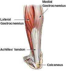 This is in the calf, about two inches above the heel bone. Achilles Tendon Rupture Core Em