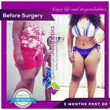In 2018, she began working for spectrum health in their interventional spine department as a nurse practitioner. You Re Always One Decision Away Spectrum Aesthetics Facebook