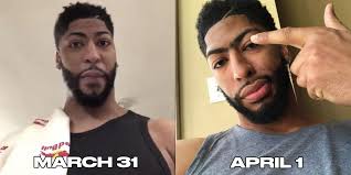 Maybe you would like to learn more about one of these? No Anthony Davis Did Not Shave His Unibrow Sbnation Com