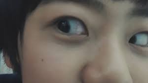 Credit to the rightful owner. Jaemin Pics On Twitter 201208 Yizhiyu Video Call Fansign Jaemin ìž¬ë¯¼ A Fan Asked Jaemin Today What Happened To The Cheek Mole He Used To Have And He Said It Was Removed