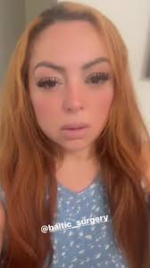 Y las que no les guste las cirujias también esta bien mientras esten f...