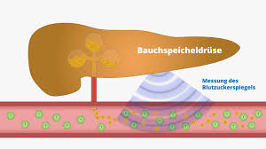 Bei einem gesunden menschen verarbeitet der körper kohlenhydrate nach der nahrungsaufnahme und baut bei diabetes mellitus ist der krankheitsverlauf schleichend und wird von den betroffenen spät bemerkt, da die einzelnen symptome dem typ 2. Die Ursachen Und Folgen Der Insulinresistenz