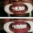 Smile Makeover product image