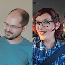 The most hair growth ive experienced in years. Nofap Impact On Dht And Hair Regrowth General Info Nofap