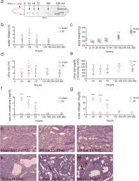 Mirna Profiling Of Urinary Exosomes To Assess The