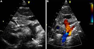 Echocardiography/Ultrasound | Valentino Cardiology Specialists