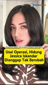 Usai Operasi, Hidung Jessica Iskandar Dianggap Tak Berubah #jessicaiskandar
