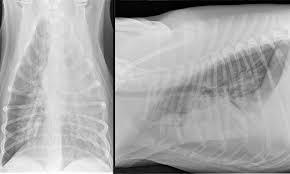 Being one of highly differentiated forms of lung cancer it is characterized by mostly peripheral localization and intraalveolar growth without significant destruction of respiratory tissue architectonics. Infectious Respiratory Disease In A Dog Clinician S Brief