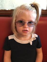 A few words about Down syndrome