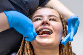 Braces Pain: What's Normal, What's Not, and How to Find Relief