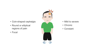 Image result for Acute Localized Headache