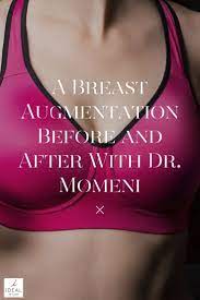 Pin On Breast Enlargement Options For Breast Implants