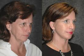 Picking up the slack