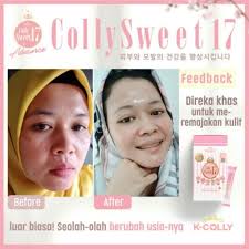 I will show you which collagen supplement works best? Original K Colly Sweet 17 By Lady Boss Rafa Shopee Malaysia