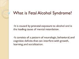 Dystonia is a neurologic syndrome characterized by involuntary, sustained, patterned, and often repetitive muscle contractions of opposing muscles. Fetal Alcohol Syndrome By Melissa Sterling Questions Should Legal Policies Be Developed In Regard To Fas Should Parents Be Charged With Child Abuse Ppt Download