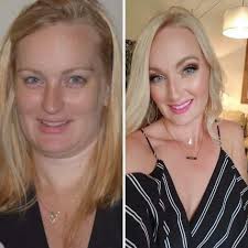 I always joke that the universe makes me go through some bout of illness or  injury so I can learn to repair my body and share that information with the  world. If