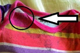 Penyebab utama jeans jamuran itu kan udah jelas, celana lembab karena keringat dan disimpan atau diletakkan di dlm ruangan yg lembab. Muncul Bintik Hitam Di Pakaian Jangan Khawatir Begini 4 Cara Menghilangkannya
