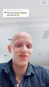 Reply to @iguessemo I apologize 😂 #alopecia #bald #funny #nohair  #ColorCustomizer #FashionFavorites #alopeciaawareness #alopeciaareata