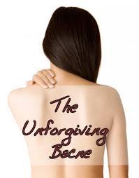 11 Simple Tips To Get Rid Of Bacne Back Acne Bacne Beauty Skin Care Natural Skin Care