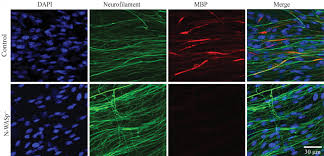An important component of the peripheral nervous system through this article, we endeavor to furnish information related to schwann cell. Schwann Cells And N Wasp It Always Comes Down To Actin The Node