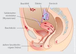Klettenwurzel für darm, leber, nieren, prostata, gebärmutter medizin gemacht von der frischen klettenwurzel ist immer getrockneten wurzeln vorzuziehen. Endometriose