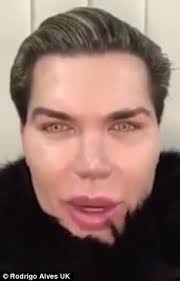 These include eye drops, pills and emerging home remedies like medical mariju. Human Ken Doll Rodrigo Alves Isn T Addicted To Surgery Daily Mail Online