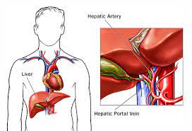 Signs and symptoms often appear once the tumour grows and causes changes in the body, such as blocking the bile ducts. Visual Guide To Liver Cancer
