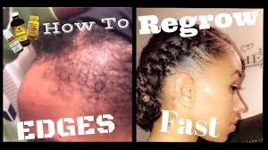In fact, a study comparing the use of 2% minoxidil and rosemary essential oil for hair loss found that individuals in both groups had a significant increase in hair count after 6 months and that there was no significant difference between the two groups. How To Regrow Edges On Natural Hair Fast Youtube