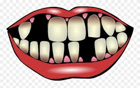 Check spelling or type a new query. Kiss Clip Art Tooth Decay Clipart Png Download 14108 Pinclipart