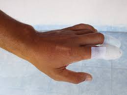 Cut-Off Finger: First Aid, Treatment, And Recovery