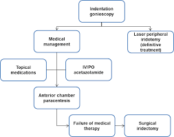 Primary Angle Closure Glaucoma Pacg Europe American Academy Of Ophthalmology