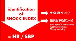 Image result for Shock Index