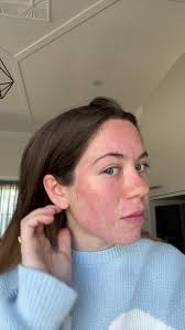 Betty Rose Face Mask