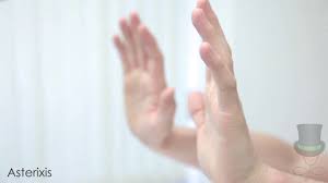 This motor disorder is characterized by an inability to maintain a position. Examination For Asterixis Youtube