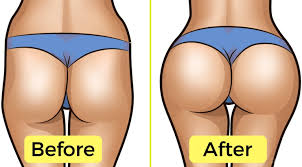 Is It Actually Possible To Get Rid Of Hip Dips How To Get Rid Of Hip Dips In A Week Top 10 Exercises Hip Dip Exercise Hips Dips Hip Workout