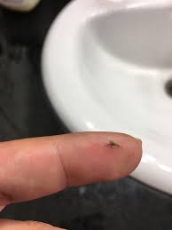 The most common cause of ingrown hair is hair removal. Ingrown Pubic Hair I Just Popped Out Popping