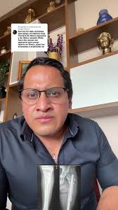 Fractura de Fémur y Tibia: Respuesta a Sergio Barron